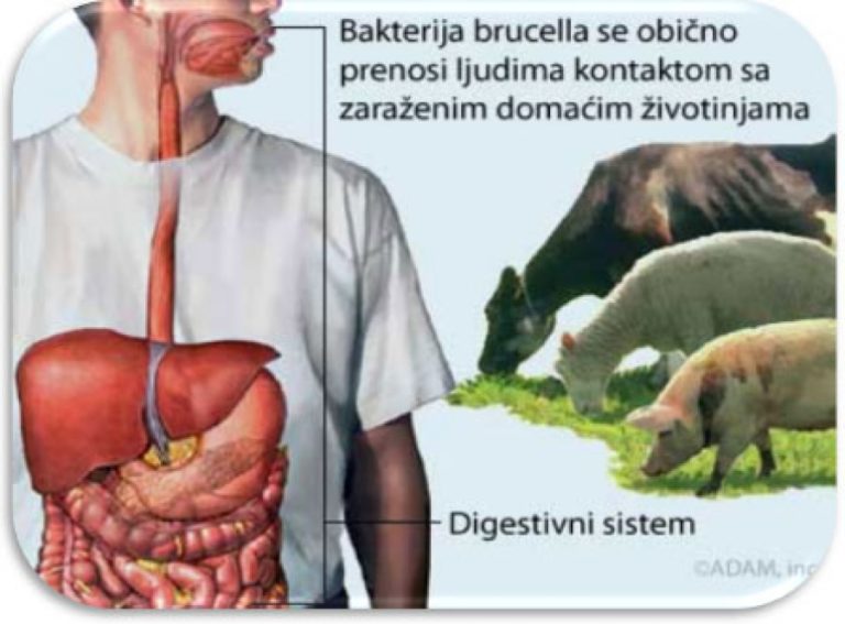 INZ – Bruceloza, opasna zarazna bolest koja traži oprez