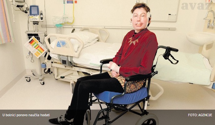 NAKON NESREĆE: Catrin Pugh uspješno preživjela 200 operacija