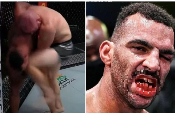 Američki UFC borac ostao bez zuba nakon razornog udarca koljenom (VIDEO)