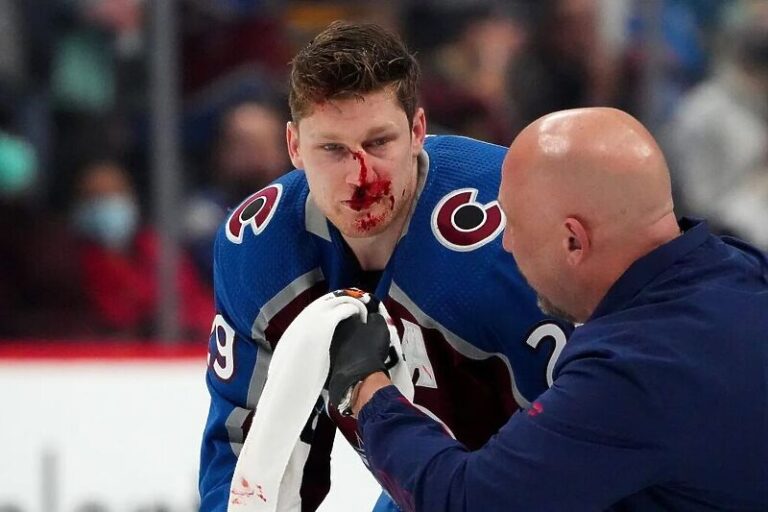 NHL zvijezdi nakon brutalnog starta slomljene sve kosti na licu