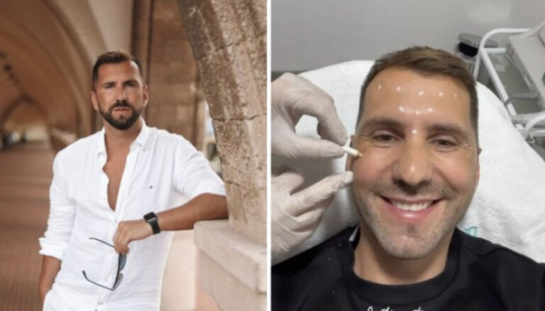 Poznati influenser Amer Kadić ruši sve predrasude: Muškarac na botox tretmanu 