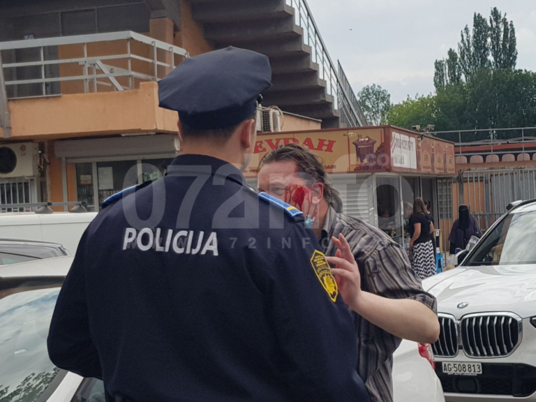 Incident u Zenici, povrijeđena jedna osoba (FOTO)