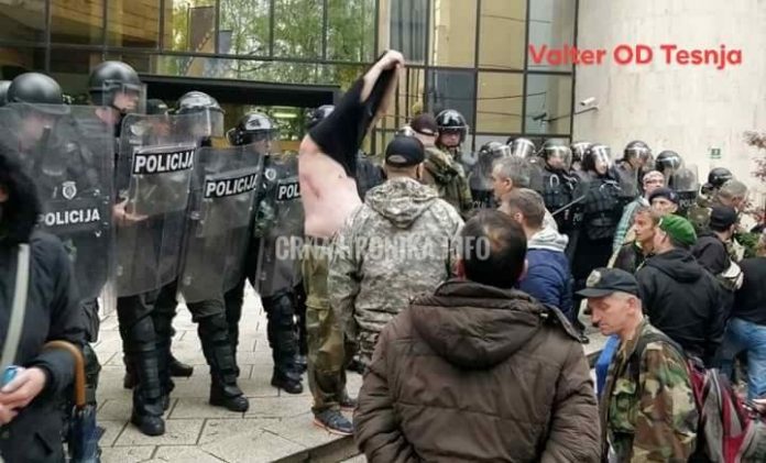 Borac iz Zenice pokazao modrice koje su nastale od policije (FOTO)