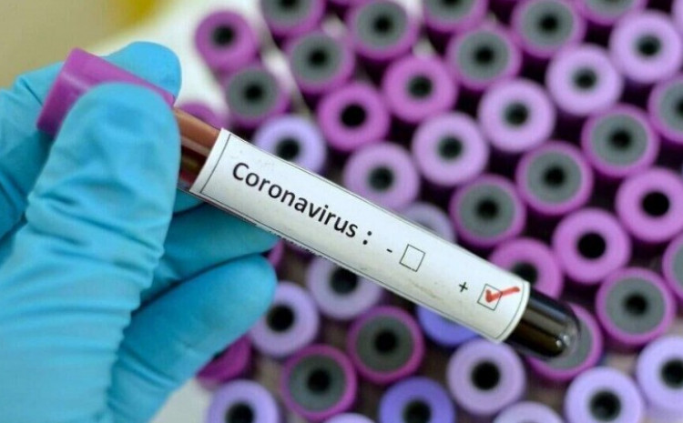 Koronavirus uvršten na listu profesionalnih bolesti