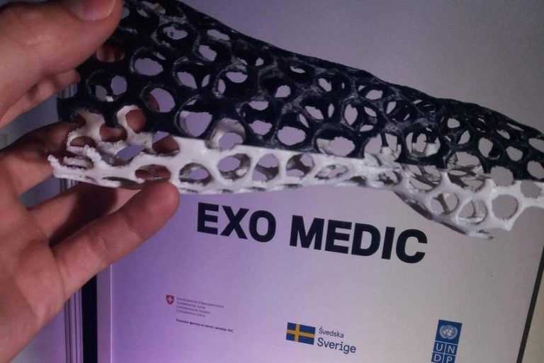 Mladi Zeničani izumili patent “Exo Medic” uz koji gips kao imobilizacijsko sredstvo postaje prošlost