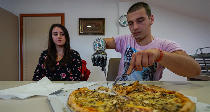 Ermin ima umjetnu ruku kojom upravlja mislima: Sada sam ponovo čovjek (FOTO)