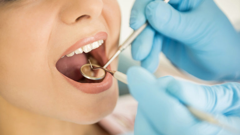 Na stomatološke preglede čeka se po mjesec dana: Ovo su cijene usluga kod zubara u BiH